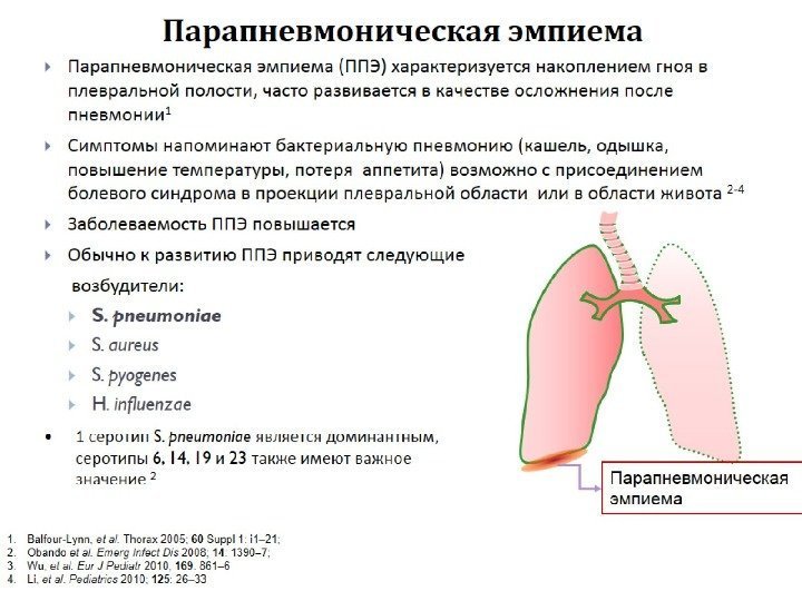 Парапневмоническая эмпиема 